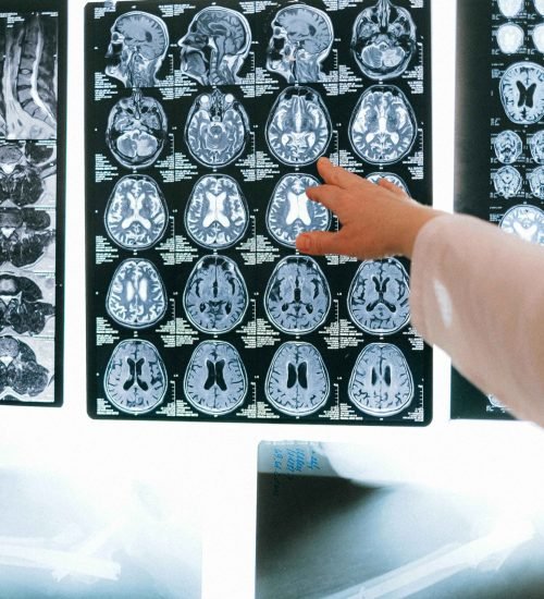 Medical brain scan images being examined by a researcher